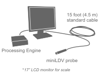 miniLDV System